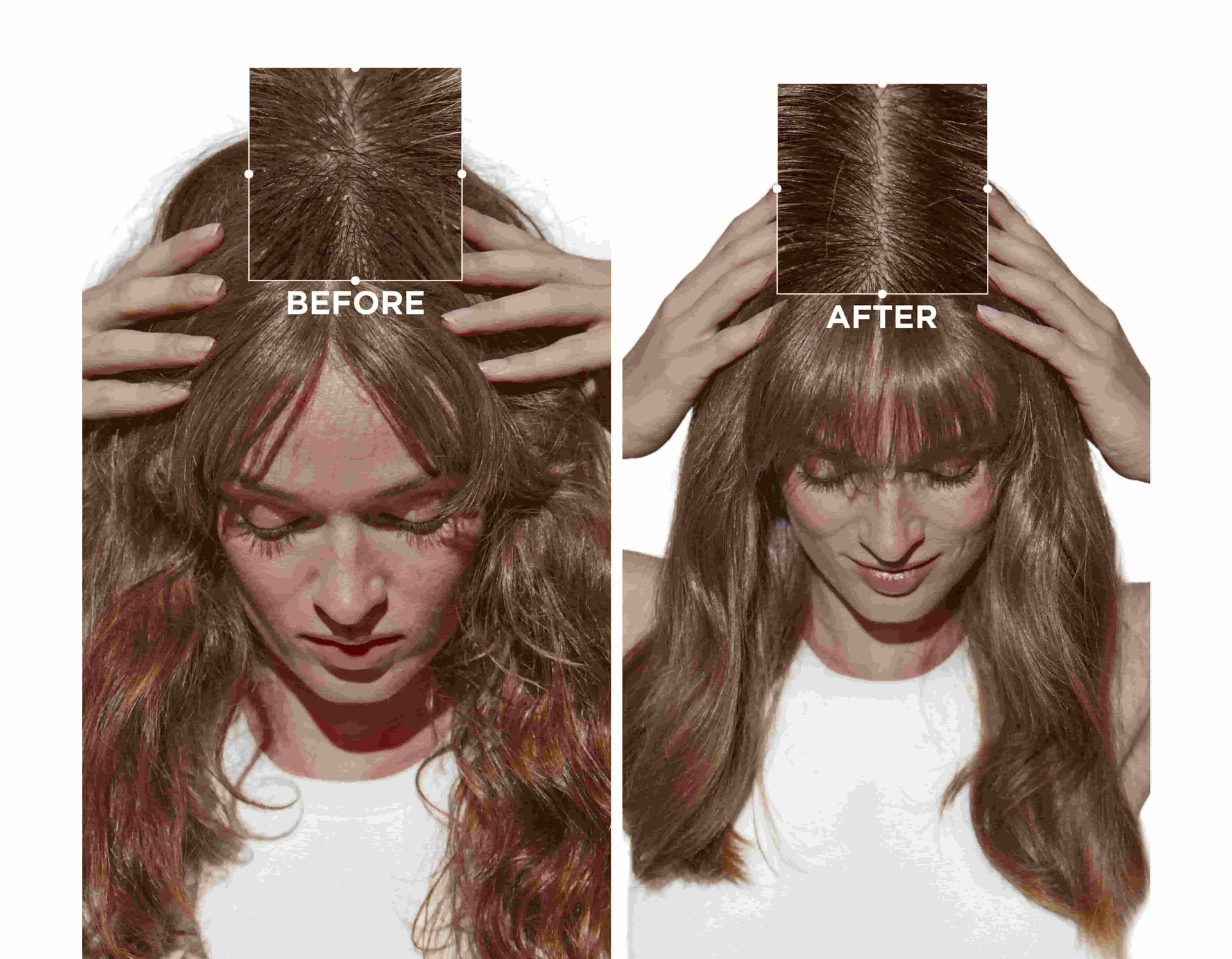 Symbiose Micro-Exfoliating Scalp Conclusion